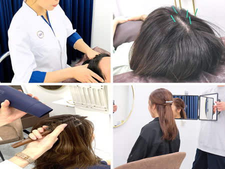 施術開始からヘアセット終わりまでの流れ
